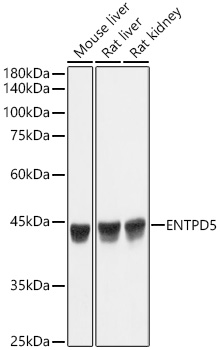 Western blot analysis of various lysates, using ENTPD5 Rabbit mAb at 1:1000 dilution.|Secondary antibody: HRP-conjugated Goat anti-Rabbit IgG (H+L) at 1:10000 dilution.|Lysates/proteins: 25μg per lane.|Blocking buffer: 3% nonfat dry milk in TBST.|Detection: ECL Basic Kit.|Exposure time: 1s.