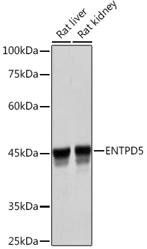 Western blot analysis of various lysates using ENTPD5 Rabbit mAb at 1:3000 dilution.|Secondary antibody: HRP-conjugated Goat anti-Rabbit IgG (H+L) at 1:10000 dilution.|Lysates/proteins: 25μg per lane.|Blocking buffer: 3% nonfat dry milk in TBST.|Detection: ECL Basic Kit.|Exposure time: 1s.
