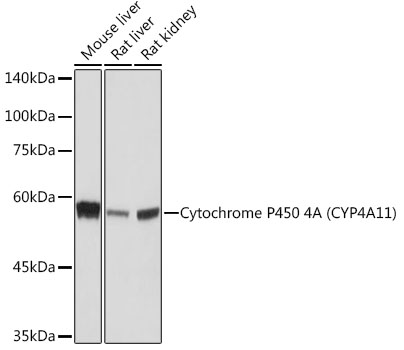 Western blot analysis of various lysates using Cytochrome P450 4A (CYP4A11) (CYP4A11) Rabbit mAb at 1:1000 dilution.|Secondary antibody: HRP-conjugated Goat anti-Rabbit IgG (H+L) at 1:10000 dilution.|Lysates/proteins: 25μg per lane.|Blocking buffer: 3% nonfat dry milk in TBST.|Detection: ECL Basic Kit.|Exposure time: 10s.