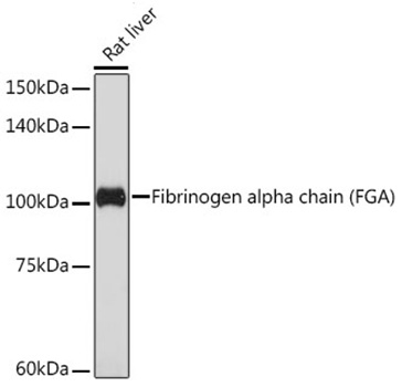 Western blot analysis of various lysates using Fibrinogen alpha chain (FGA) (FGA) Rabbit mAb at 1:1000 dilution.|Secondary antibody: HRP-conjugated Goat anti-Rabbit IgG (H+L) at 1:10000 dilution.|Lysates/proteins: 25μg per lane.|Blocking buffer: 3% nonfat dry milk in TBST.|Detection: ECL Basic Kit.|Exposure time: 180s.