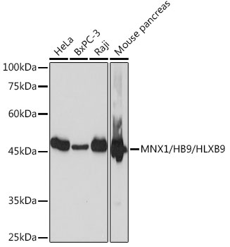 Western blot analysis of various lysates using MNX1/MNX1/HB9/HLXB9 Rabbit mAb at 1:1000 dilution.|Secondary antibody: HRP-conjugated Goat anti-Rabbit IgG (H+L) at 1:10000 dilution.|Lysates/proteins: 25μg per lane.|Blocking buffer: 3% nonfat dry milk in TBST.|Detection: ECL Basic Kit.|Exposure time: 1s.