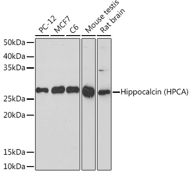 Western blot analysis of various lysates using Hippocalcin (HPCA) (HPCA) Rabbit mAb at 1:1000 dilution.|Secondary antibody: HRP-conjugated Goat anti-Rabbit IgG (H+L) at 1:10000 dilution.|Lysates/proteins: 25μg per lane.|Blocking buffer: 3% nonfat dry milk in TBST.|Detection: ECL Basic Kit.|Exposure time: 180s.