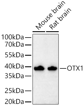 Western blot analysis of various lysates using OTX1 Rabbit mAb at 1:5000 dilution incubated at room temperature for 1.5 hours.|Secondary antibody: HRP-conjugated Goat anti-Rabbit IgG (H+L) at 1:10000 dilution.|Lysates/proteins: 25 μg per lane.|Blocking buffer: 3% nonfat dry milk in TBST.|Detection: ECL Basic Kit.|Exposure time: 45 s.