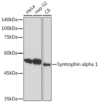 Western blot analysis of various lysates using Syntrophin alpha 1 Rabbit mAb at 1:1000 dilution.|Secondary antibody: HRP-conjugated Goat anti-Rabbit IgG (H+L) at 1:10000 dilution.|Lysates/proteins: 25μg per lane.|Blocking buffer: 3% nonfat dry milk in TBST.|Detection: ECL Basic Kit.|Exposure time: 10s.