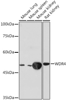 Western blot analysis of various lysates using WDR4 Rabbit mAb at 1:1000 dilution.|Secondary antibody: HRP-conjugated Goat anti-Rabbit IgG (H+L) at 1:10000 dilution.|Lysates/proteins: 25μg per lane.|Blocking buffer: 3% nonfat dry milk in TBST.|Detection: ECL Basic Kit.|Exposure time: 10s.