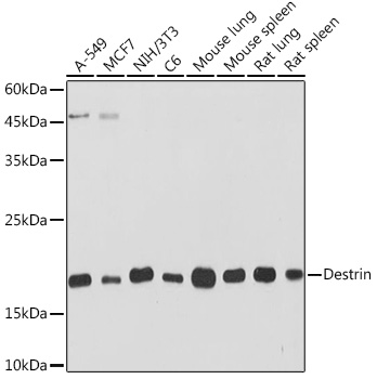 Western blot analysis of various lysates using Destrin Rabbit mAb at 1:1000 dilution.|Secondary antibody: HRP-conjugated Goat anti-Rabbit IgG (H+L) at 1:10000 dilution.|Lysates/proteins: 25μg per lane.|Blocking buffer: 3% nonfat dry milk in TBST.|Detection: ECL Basic Kit.|Exposure time: 30s.