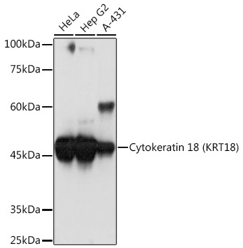 Western blot analysis of various lysates using Cytokeratin 18 (KRT18) Rabbit mAb at 1:1000 dilution.|Secondary antibody: HRP-conjugated Goat anti-Rabbit IgG (H+L) at 1:10000 dilution.|Lysates/proteins: 25μg per lane.|Blocking buffer: 3% nonfat dry milk in TBST.|Detection: ECL Basic Kit.|Exposure time: 1s.