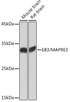 Western blot analysis of various lysates using EB3/MAPRE3 Rabbit mAb at 1:1000 dilution.|Secondary antibody: HRP-conjugated Goat anti-Rabbit IgG (H+L) at 1:10000 dilution.|Lysates/proteins: 25μg per lane.|Blocking buffer: 3% nonfat dry milk in TBST.|Detection: ECL Basic Kit.|Exposure time: 1s.