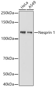 Western blot analysis of various lysates using Nesprin 1 Rabbit mAb at 1:1000 dilution.| Secondary antibody: HRP-conjugated Goat anti-Rabbit IgG (H+L) at 1:10000 dilution.| Lysates / proteins: 25 μg per lane.| Blocking buffer: 3 % nonfat dry milk in TBST.| Detection: ECL Basic Kit.| Exposure time: 10s.