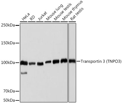 Western blot analysis of various lysates using Transportin 3 (Transportin 3 (TNPO3)) Rabbit mAb at 1:1000 dilution.|Secondary antibody: HRP-conjugated Goat anti-Rabbit IgG (H+L) at 1:10000 dilution.|Lysates/proteins: 25μg per lane.|Blocking buffer: 3% nonfat dry milk in TBST.|Detection: ECL Basic Kit.|Exposure time: 3s.