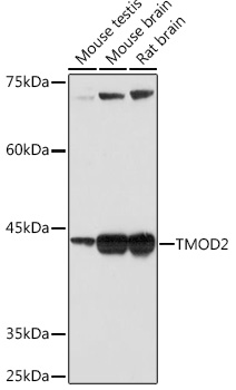 Western blot analysis of various lysates using TMOD2 Rabbit mAb at 1:1000 dilution.|Secondary antibody: HRP-conjugated Goat anti-Rabbit IgG (H+L) at 1:10000 dilution.|Lysates/proteins: 25μg per lane.|Blocking buffer: 3% nonfat dry milk in TBST.|Detection: ECL Basic Kit.|Exposure time: 60s.