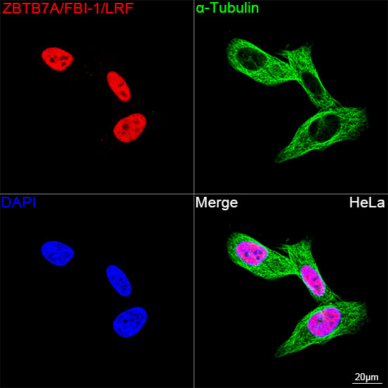 Confocal imaging of HeLa cells using ZBTB7A/FBI-1/LRF Rabbit mAb  followed by a further incubation with Cy3 Goat Anti-Rabbit IgG (H+L) (Red). The cells were counterstained with α-Tubulin Mouse mAb followed by incubation with PSFlo 488-conjugated Goat Anti-Mouse IgG (H+L) Ab (Green). DAPI was used for nuclear staining (Blue). Objective: 100x.
