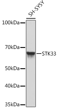 Western blot analysis of lysates from SH-SY5Y cells, using STK33 Rabbit mAb at 1:1000 dilution.|Secondary antibody: HRP-conjugated Goat anti-Rabbit IgG (H+L) at 1:10000 dilution.|Lysates/proteins: 25μg per lane.|Blocking buffer: 3% nonfat dry milk in TBST.|Detection: ECL Basic Kit.|Exposure time: 10s.