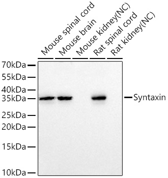 Western blot analysis of various lysates using Syntaxin Rabbit mAb at 1:1000 dilution incubated overnight at 4℃.|Secondary antibody: HRP-conjugated Goat anti-Rabbit IgG (H+L) at 1:10000 dilution.|Lysates/proteins: 25 μg per lane.|Blocking buffer: 3% nonfat dry milk in TBST.|Detection: ECL Basic Kit.|Negative control (NC): Mouse kidney, Rat kidney.|Exposure time: 30 s.