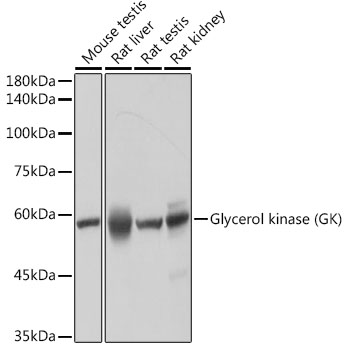 Western blot analysis of various lysates using Glycerol kinase (GK) Rabbit mAb at 1:1000 dilution.|Secondary antibody: HRP-conjugated Goat anti-Rabbit IgG (H+L) at 1:10000 dilution.|Lysates/proteins: 25μg per lane.|Blocking buffer: 3% nonfat dry milk in TBST.|Detection: ECL Basic Kit.|Exposure time: 10s.