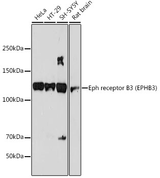 Western blot analysis of various lysates using Eph receptor B3 (EPHB3) Rabbit mAb at 1:1000 dilution.|Secondary antibody: HRP-conjugated Goat anti-Rabbit IgG (H+L) at 1:10000 dilution.|Lysates/proteins: 25μg per lane.|Blocking buffer: 3% nonfat dry milk in TBST.|Detection: ECL Basic Kit.|Exposure time: 180s.