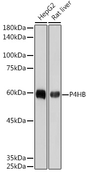 Western blot analysis of various lysates using P4HB Rabbit mAb at 1:1000 dilution.|Secondary antibody: HRP-conjugated Goat anti-Rabbit IgG (H+L) at 1:10000 dilution.|Lysates/proteins: 25μg per lane.|Blocking buffer: 3% nonfat dry milk in TBST.|Detection: ECL Basic Kit.|Exposure time: 3s.