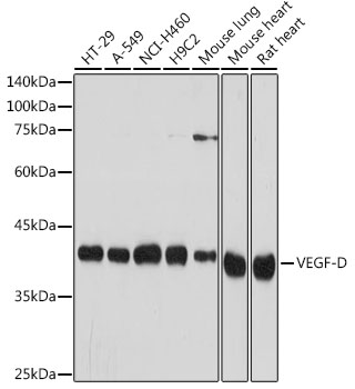 Western blot analysis of various lysates using VEGF-D Rabbit mAb at 1:1000 dilution.|Secondary antibody: HRP-conjugated Goat anti-Rabbit IgG (H+L) at 1:10000 dilution.|Lysates/proteins: 25μg per lane.|Blocking buffer: 3% nonfat dry milk in TBST.|Detection: ECL Basic Kit.|Exposure time: 10s.