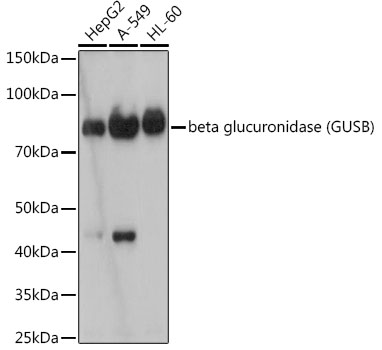 Western blot analysis of various lysates using beta glucuronidase (GUSB) Rabbit mAb at 1:1000 dilution.|Secondary antibody: HRP-conjugated Goat anti-Rabbit IgG (H+L) at 1:10000 dilution.|Lysates/proteins: 25μg per lane.|Blocking buffer: 3% nonfat dry milk in TBST.|Detection: ECL Basic Kit.|Exposure time: 180s.