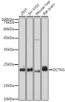Western blot analysis of various lysates, using DCTN5 Rabbit mAb at 1:1000 dilution.|Secondary antibody: HRP-conjugated Goat anti-Rabbit IgG (H+L) at 1:10000 dilution.|Lysates/proteins: 25μg  per lane.|Blocking buffer: 3% nonfat dry milk in TBST.|Detection: ECL Basic Kit.|Exposure time: 10s.