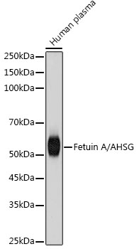 Western blot analysis of lysates from Human plasma, using Fetuin A/AHSG Rabbit mAb at 1:1000 dilution.|Secondary antibody: HRP-conjugated Goat anti-Rabbit IgG (H+L) at 1:10000 dilution.|Lysates/proteins: 25μg per lane.|Blocking buffer: 3% nonfat dry milk in TBST.|Detection: ECL Basic Kit.|Exposure time: 1s.