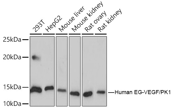 Western blot analysis of various lysates using Human EG-VEGF/PK1 Rabbit mAb at 1:1000 dilution.|Secondary antibody: HRP-conjugated Goat anti-Rabbit IgG (H+L) at 1:10000 dilution.|Lysates/proteins: 25μg per lane.|Blocking buffer: 3% nonfat dry milk in TBST.|Detection: ECL Basic Kit.|Exposure time: 180s.