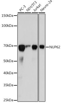 Western blot analysis of various lysates using NUP62 Rabbit mAb at 1:1000 dilution.|Secondary antibody: HRP-conjugated Goat anti-Rabbit IgG (H+L) at 1:10000 dilution.|Lysates/proteins: 25μg per lane.|Blocking buffer: 3% nonfat dry milk in TBST.|Detection: ECL Basic Kit.|Exposure time: 3s.