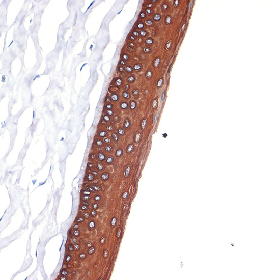 Immunohistochemistry analysis of paraffin-embedded Rat cornea using Cytokeratin 12 (KRT12) (KRT12) Rabbit mAb at dilution of 1:100 (40x lens). Microwave antigen retrieval performed with 0.01M Tris/EDTA Buffer (pH 9.0) prior to IHC staining.