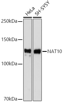 Western blot analysis of various lysates using NAT10 Rabbit mAb at 1:1000 dilution.|Secondary antibody: HRP-conjugated Goat anti-Rabbit IgG (H+L) at 1:10000 dilution.|Lysates/proteins: 25μg per lane.|Blocking buffer: 3% nonfat dry milk in TBST.|Detection: ECL Basic Kit.|Exposure time: 3s.