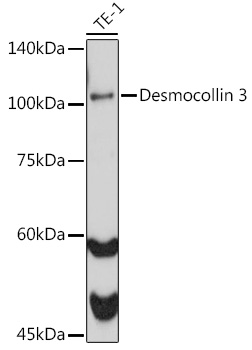 Western blot analysis of lysates from TE-1 cells, using Desmocollin 3 Rabbit mAb at 1:1000 dilution.|Secondary antibody: HRP-conjugated Goat anti-Rabbit IgG (H+L) at 1:10000 dilution.|Lysates/proteins: 25μg per lane.|Blocking buffer: 3% nonfat dry milk in TBST.|Detection: ECL Basic Kit.|Exposure time: 60s.