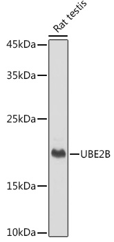 Western blot analysis of lysates from Rat testis, using UBE2B Rabbit mAb at 1:1000 dilution.|Secondary antibody: HRP-conjugated Goat anti-Rabbit IgG (H+L) at 1:10000 dilution.|Lysates/proteins: 25μg per lane.|Blocking buffer: 3% nonfat dry milk in TBST.|Detection: ECL Basic Kit.|Exposure time: 1s.