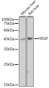 Western blot analysis of various lysates, using HDGF Rabbit mAb at 1:1000 dilution.|Secondary antibody: HRP-conjugated Goat anti-Rabbit IgG (H+L) at 1:10000 dilution.|Lysates/proteins: 25μg per lane.|Blocking buffer: 3% nonfat dry milk in TBST.|Detection: ECL Basic Kit.|Exposure time: 1s.