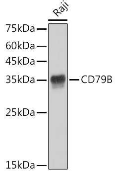 Western blot analysis of lysates from Raji cells, using CD79B Rabbit mAb at 1:1000 dilution.|Secondary antibody: HRP-conjugated Goat anti-Rabbit IgG (H+L) at 1:10000 dilution.|Lysates/proteins: 25μg per lane.|Blocking buffer: 3% nonfat dry milk in TBST.|Detection: ECL Basic Kit.|Exposure time: 1s.
