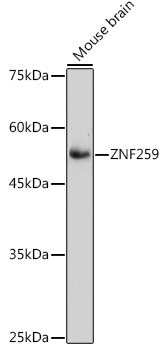 Western blot analysis of lysates from Mouse brain, using ZNF259 Rabbit mAb at 1:1000 dilution.|Secondary antibody: HRP-conjugated Goat anti-Rabbit IgG (H+L) at 1:10000 dilution.|Lysates/proteins: 25μg per lane.|Blocking buffer: 3% nonfat dry milk in TBST.|Detection: ECL Basic Kit.|Exposure time: 90s.