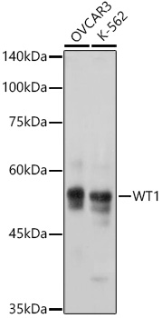 Western blot analysis of various lysates using WT1 Rabbit mAb at 1:1000 dilution incubated overnight at 4℃.|Secondary antibody: HRP-conjugated Goat anti-Rabbit IgG (H+L) at 1:10000 dilution.|Lysates/proteins: 25μg per lane.|Blocking buffer: 3% nonfat dry milk in TBST.|Detection: ECL Basic Kit.|Exposure time: 1s.