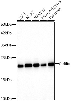 Western blot analysis of various lysates using Cofilin Rabbit mAb at 1:1000 dilution incubated overnight at 4℃.|Secondary antibody: HRP-conjugated Goat anti-Rabbit IgG (H+L) at 1:10000 dilution.|Lysates/proteins: 25 μg per lane.|Blocking buffer: 3% nonfat dry milk in TBST.|Detection: ECL Basic Kit.|Exposure time: 10s.