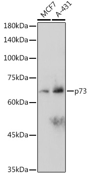 Western blot analysis of various lysates using p73 Rabbit mAb at 1:1000 dilution.|Secondary antibody: HRP-conjugated Goat anti-Rabbit IgG (H+L) at 1:10000 dilution.|Lysates/proteins: 25μg per lane.|Blocking buffer: 3% nonfat dry milk in TBST.|Detection: ECL Basic Kit.|Exposure time: 180s.