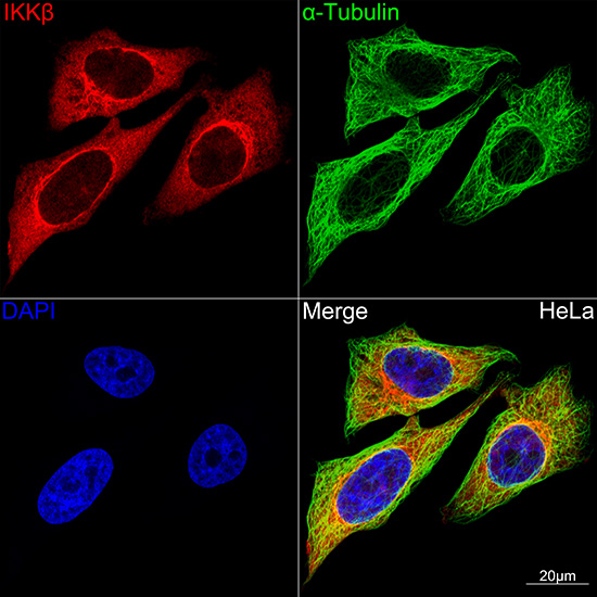Confocal imaging of HeLa cells using IKKβ Rabbit mAb(Red). The cells were counterstained with α-Tubulin Mouse mAb (Green). DAPI was used for nuclear staining (blue). Objective: 100x.
