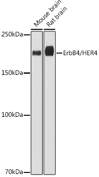 Western blot analysis of various lysates using ErbB4/HER4 Rabbit mAb at 1:1000 dilution.|Secondary antibody: HRP-conjugated Goat anti-Rabbit IgG (H+L) at 1:10000 dilution.|Lysates/proteins: 25μg per lane.|Blocking buffer: 3% nonfat dry milk in TBST.|Detection: ECL Basic Kit.|Exposure time: 180s.