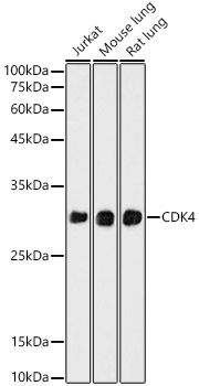 Western blot analysis of various lysates, using CDK4 Rabbit mAb at 1:1000 dilution.|Secondary antibody: HRP-conjugated Goat anti-Rabbit IgG (H+L) at 1:10000 dilution.|Lysates/proteins: 25μg per lane.|Blocking buffer: 3% nonfat dry milk in TBST.|Detection: ECL Basic Kit.|Exposure time: 180s.