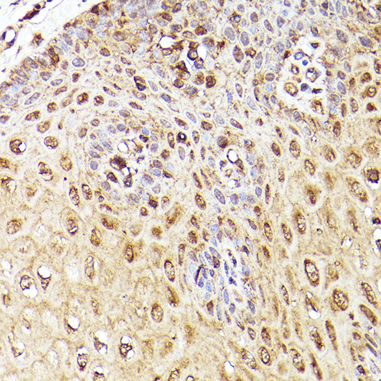 Immunohistochemistry analysis of paraffin-embedded Human esophagus using K63-linkage Specific Ubiquitin Rabbit mAb at dilution of 1:100 (40x lens). High pressure antigen retrieval performed with 0.01M Citrate buffer (pH 6.0) prior to IHC staining.