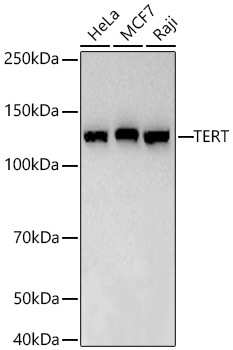 Western blot analysis of various lysates using TERT Rabbit mAb at 1:1000 dilution incubated overnight at 4℃.|Secondary antibody: HRP-conjugated Goat anti-Rabbit IgG (H+L) at 1:10000 dilution.|Lysates/proteins: 25 μg per lane.|Blocking buffer: 3% nonfat dry milk in TBST.|Detection: ECL Basic Kit.|Exposure time: 90s.