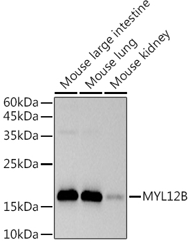 Western blot analysis of various lysates using  MYL12B Rabbit mAb at 1:500 dilution.|Secondary antibody: HRP-conjugated Goat anti-Rabbit IgG (H+L) at 1:10000 dilution.|Lysates/proteins: 25μg per lane.|Blocking buffer: 3% nonfat dry milk in TBST.|Detection: ECL Basic Kit.|Exposure time: 3s.