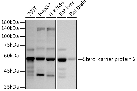 Western blot analysis of various lysates using  at 1:1000 dilution.|Secondary antibody: HRP-conjugated Goat anti-Rabbit IgG (H+L) at 1:10000 dilution.|Lysates/proteins: 25μg per lane.|Blocking buffer: 3% nonfat dry milk in TBST.|Detection: ECL Basic Kit.|Exposure time: 5s.