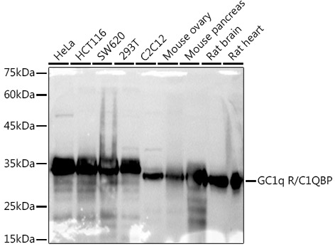 Western blot analysis of various lysates using GC1q R/C1QBP Rabbit mAb at 1:1000 dilution.|Secondary antibody: HRP-conjugated Goat anti-Rabbit IgG (H+L) at 1:10000 dilution.|Lysates/proteins: 25μg per lane.|Blocking buffer: 3% nonfat dry milk in TBST.|Detection: ECL Basic Kit.|Exposure time: 10s.