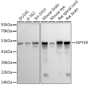 Western blot analysis of various lysates using at 1:500 dilution.|Secondary antibody: HRP-conjugated Goat anti-Rabbit IgG (H+L) at 1:10000 dilution.|Lysates/proteins: 25 μg per lane.|Blocking buffer: 3% nonfat dry milk in TBST.|Detection: ECL Basic Kit.|Exposure time: 0.5 s.