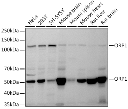 Western blot analysis of various lysates, using  ORP1 Rabbit mAb at 1:1000 dilution.|Secondary antibody: HRP-conjugated Goat anti-Rabbit IgG (H+L) at 1:10000 dilution.|Lysates/proteins: 25μg per lane.|Blocking buffer: 3% nonfat dry milk in TBST.|Detection: ECL Basic Kit.|Exposure time: 30s.