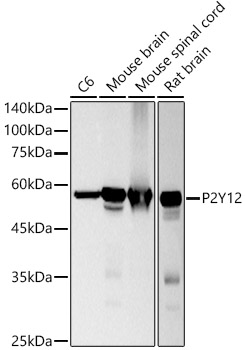 Western blot analysis of various lysates using P2Y12 Rabbit mAb at 1:1000 dilution.|Secondary antibody: HRP-conjugated Goat anti-Rabbit IgG (H+L) at 1:10000 dilution.|Lysates/proteins: 25μg per lane.|Blocking buffer: 3% nonfat dry milk in TBST.|Detection: ECL Basic Kit.|Exposure time: 3s.