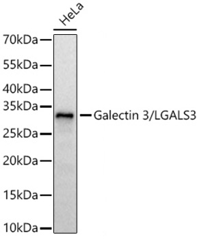 Western blot analysis of various lysates using Galectin 3/LGALS3 Rabbit mAb at 1:1000 dilution incubated at room temperature for 1.5 hours.|Secondary antibody: HRP-conjugated Goat anti-Rabbit IgG (H+L) at 1:10000 dilution.|Lysates/proteins: 25 μg per lane.|Blocking buffer: 3% nonfat dry milk in TBST.|Detection: ECL Basic Kit.|Exposure time: 0.5s.