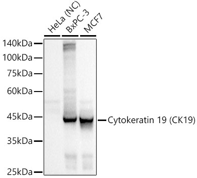 Western blot analysis of various lysates using Cytokeratin 19 (CK19) Rabbit mAb at 1:500 dilution incubated overnight at 4℃.|Secondary antibody: HRP-conjugated Goat anti-Rabbit IgG (H+L) at 1:10000 dilution.|Lysates/proteins: 25μg per lane.|Blocking buffer: 3% nonfat dry milk in TBST.|Detection: ECL Basic Kit.|Negative control (NC): HeLa|Exposure time: 0.5s.